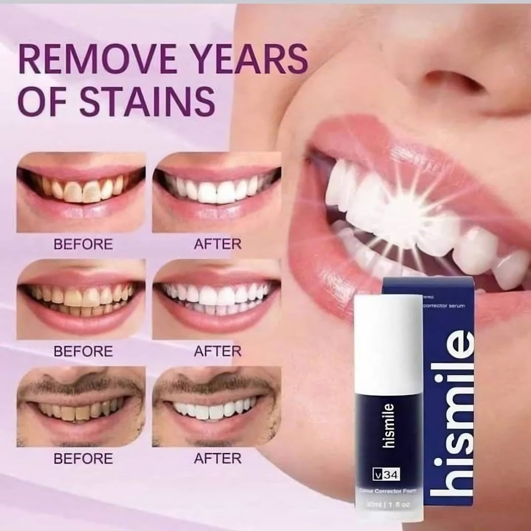 HiSmile V34 Teeth Whitening Purple Toothpaste – Color Corrector Serum for Yellow Stain Removal & Bright White Teeth