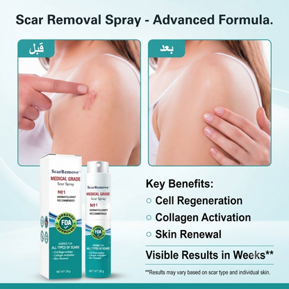 Scar Removal Spray for Face & Body – Advanced Skin Repair Formula